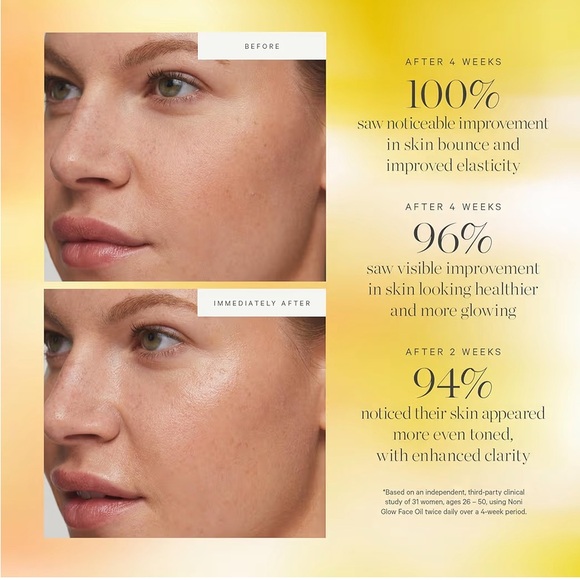 KORA Organics Noni Glow Face Oil - Picture 2 of 9